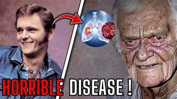 Uncover The Tragic Truth: Jerry Reed's Final Days