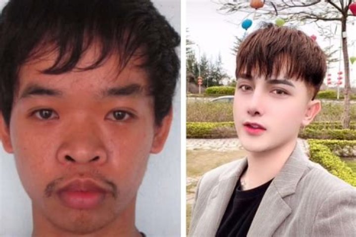 Vietnamese man gets numerous plastic surgeries to look like a Kpop
