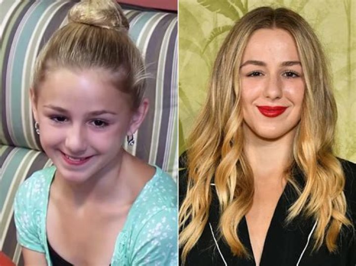 What happened to Chlo&eacute; Lukasiak's girlfriend's nose? Why does Brooklinn