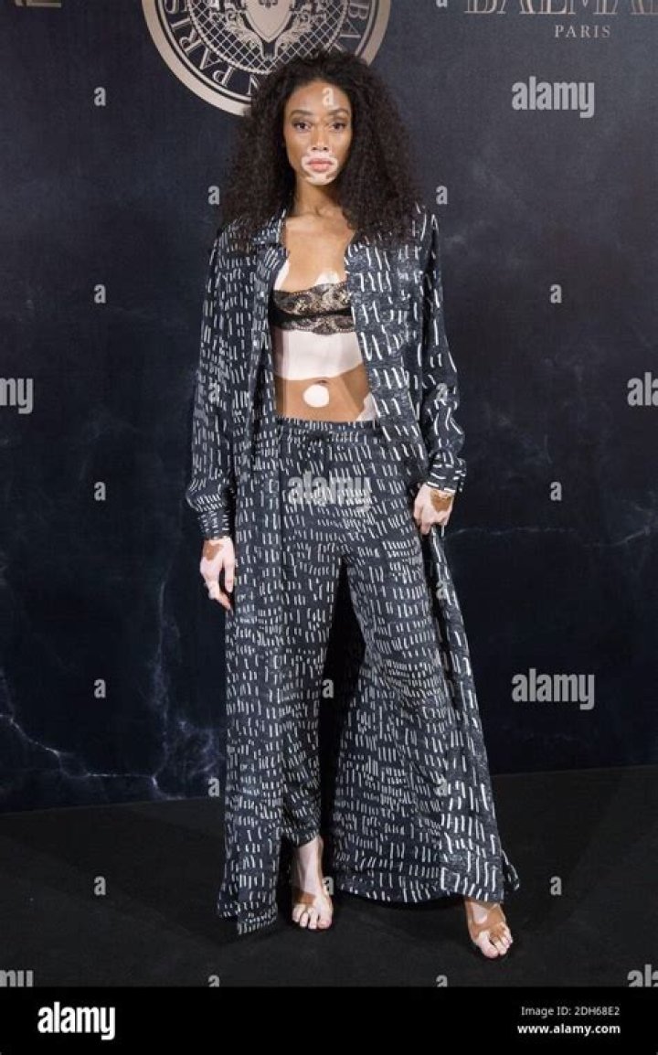 Winnie Harlow L&rsquo;Oreal X Balmain Party in Paris 09/28/2017 &bull; CelebMafia