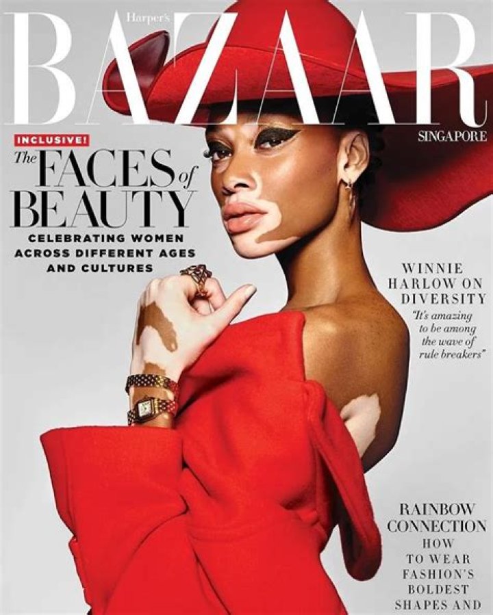 Winnie Harlow Outside Harper&rsquo;s Bazaar Icons Party in NYC 9/7/18