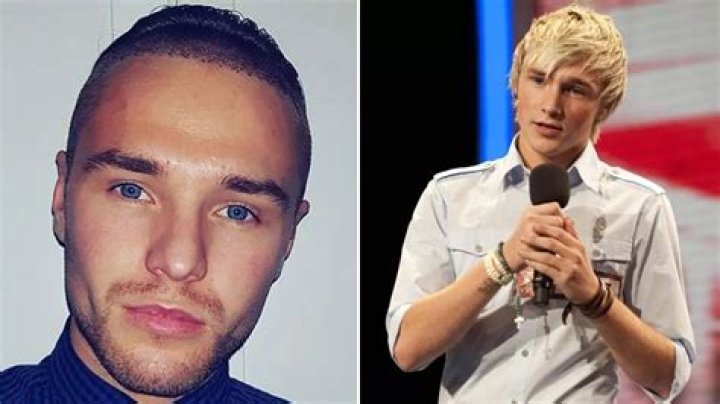 X Factor star Lloyd Daniels undergoes hair transplant after opening up