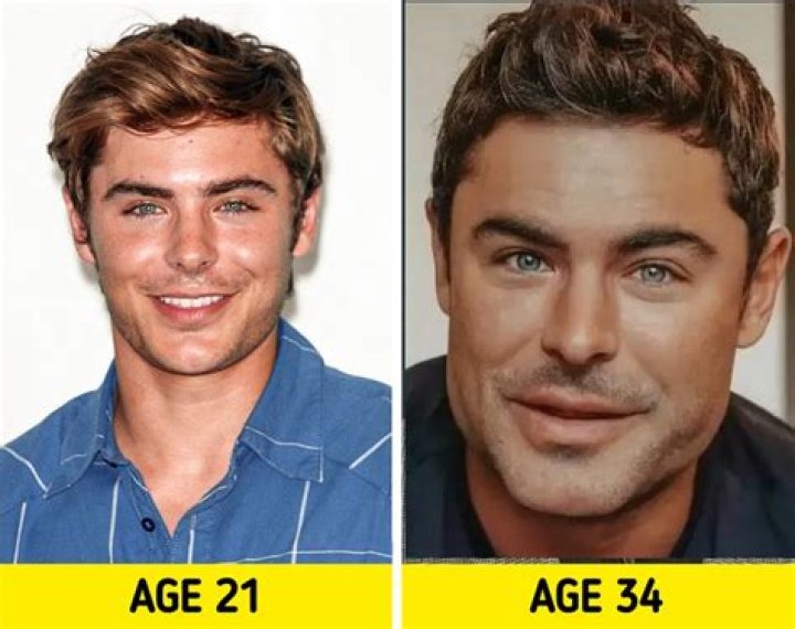 Zac Efron before and after plastic surgery (19) Celebrity plastic