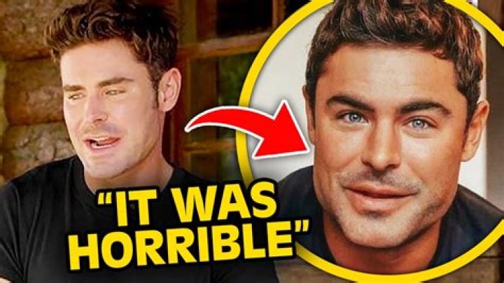 Zac Efron displays swollen face and large scar on his chin after