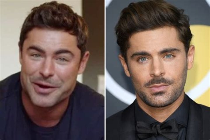 Zac Efron hits back at plastic surgery claims and reveals the real